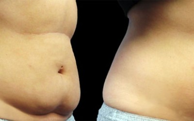 The Easy Way to Get Rid of Stubborn Fat Deposits!