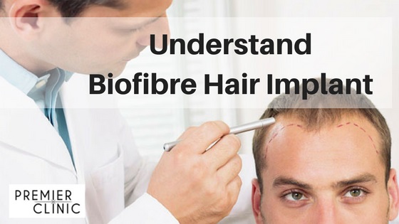 Biofibre Hair Implant FAQ