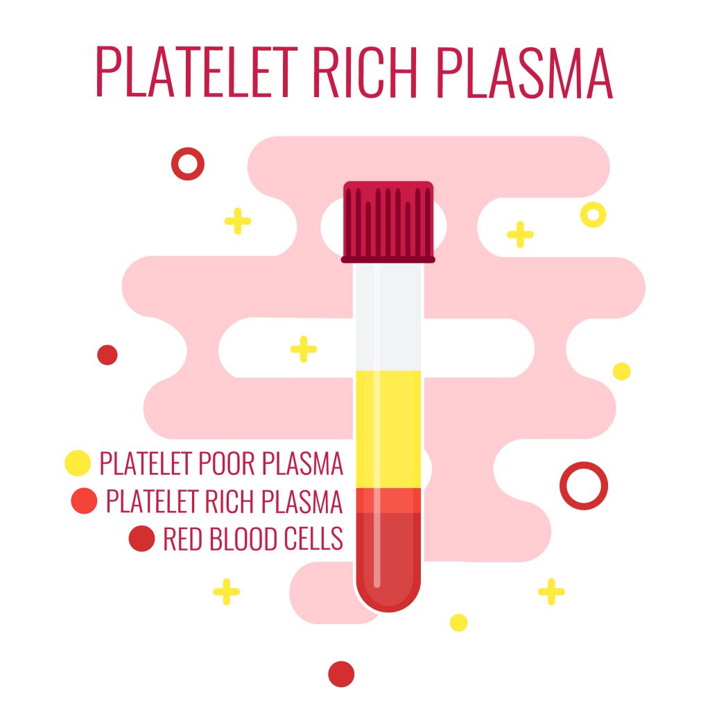 Breast Enhancement With Platelet-Rich Plasma (PRP)